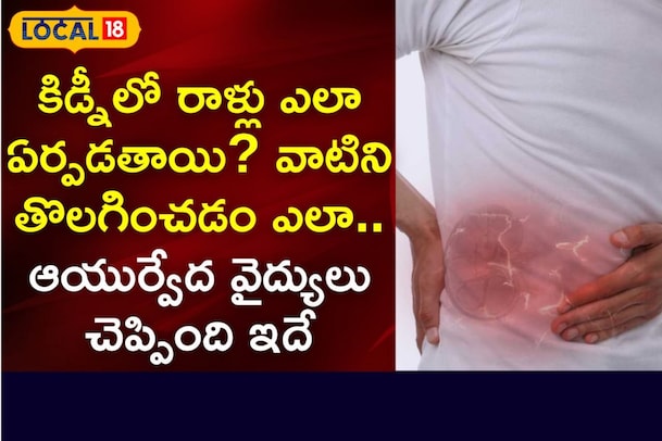 Health Tips: కిడ్నీలో రాళ్లు ఉన్నాయా.. నో టెన్షన్.. అద్భుతమైన చిట్కా మీ కోసమే..?