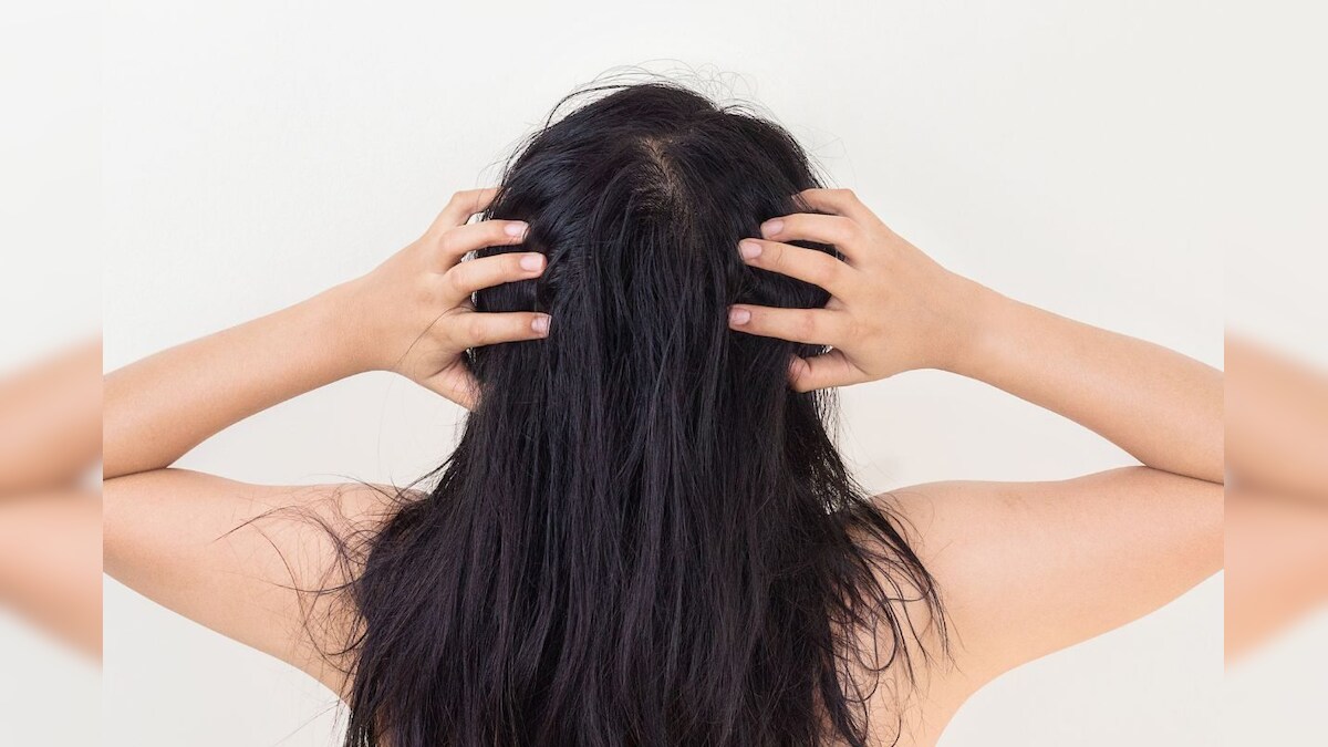 How to get rid of hair itching problems – Hair Tips: తలలో బాగా దురదగా ...