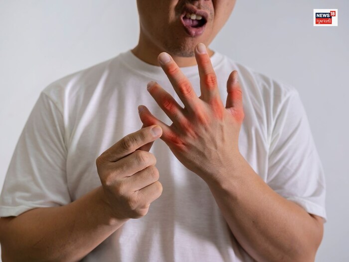 Uric Acid యూరిక్ యాసిడ్ పదే పదే పెరగడానికి ఏ కూరగాయ కారణమో తెలుసా