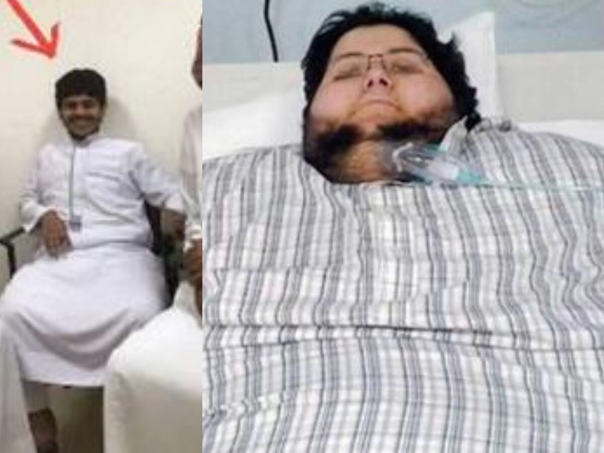 610 కేజీలతో బండలా ఉన్న వాడ్ని.. 547 కేజీలు తగ్గించి 63.5 కేజీలతో స్లిమ్