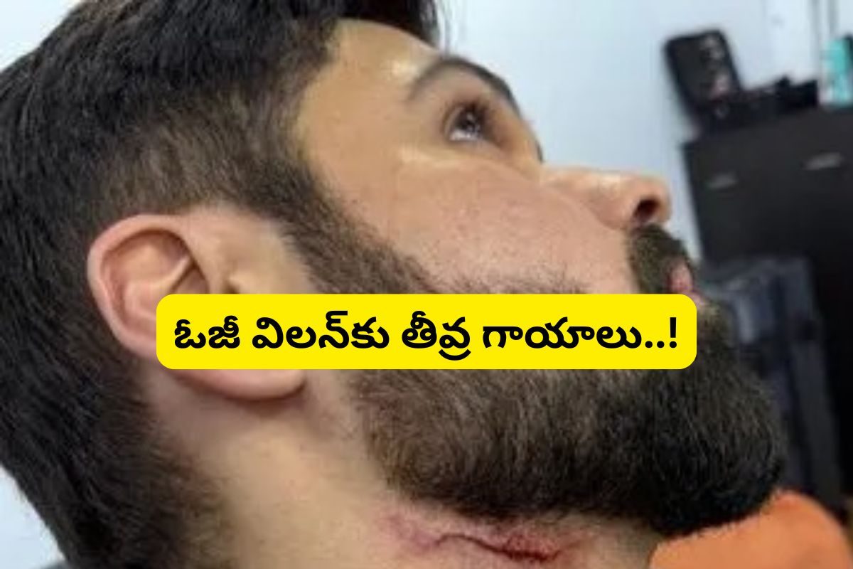 Imran Hashmi: 'ఓజీ' విలన్‌కు తీవ్ర గాయాలు... షాక్‌లో చిత్ర యూనిట్..!