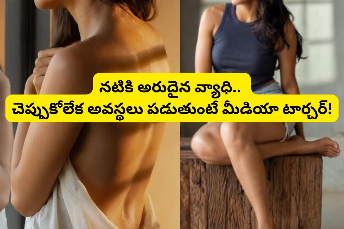 స్టార్ హీరోయిన్‌కు అరుదైన వ్యాధి..పాపం..బయటకు చెప్పుకోలేక అవస్థలు పడుతుంటే మీడియా టార్చర్!