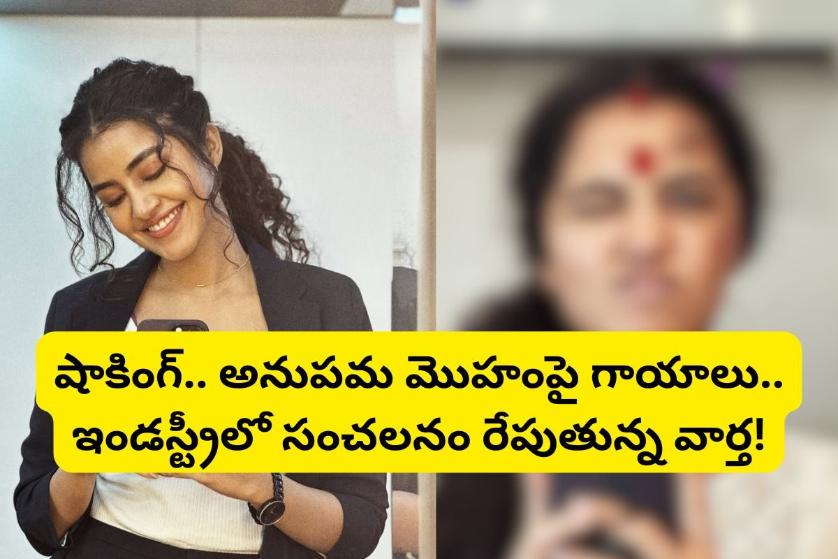 Anupama: షాకింగ్.. అనుపమ మొహంపై గాయాలు.. ఇండస్ట్రీలో సంచలనం రేపుతున్న వార్త!