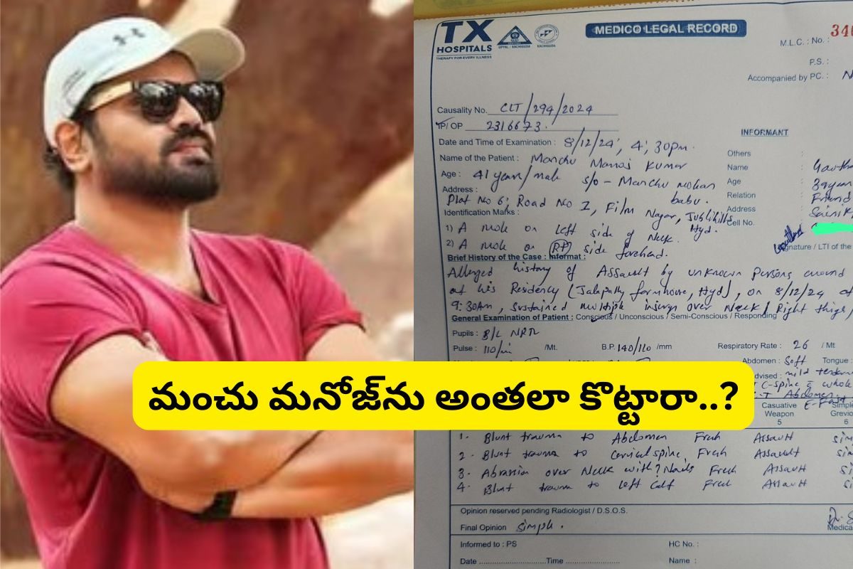Manchu Manoj: మంచు మనోజ్‌కు తీవ్ర గాయాలు.. మెడికల్‌ రిపోర్టులో ఏముందో తెలిస్తే షాక్..!