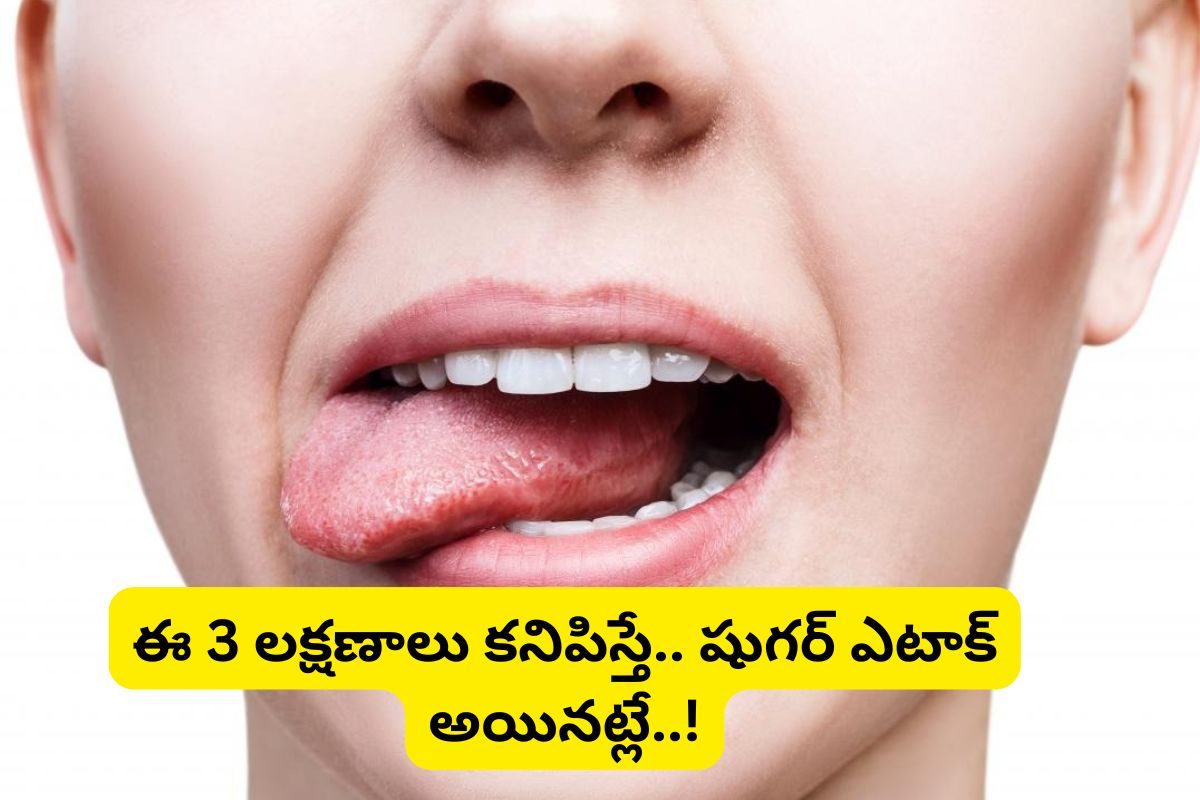 Diabetes: షుగర్ వచ్చే ముందు నోట్లో కనిపించే 3 లక్షణాలు ఇవే.. జాగ్రత్త!