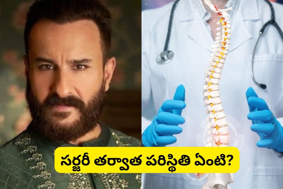 Saif ali khan: సైఫ్ అలీ ఖాన్‌కు వెన్నుముక సర్జరీ?. . శస్త్ర చికిత్స ఎంత ప్రమాదమో తెలుస్తే