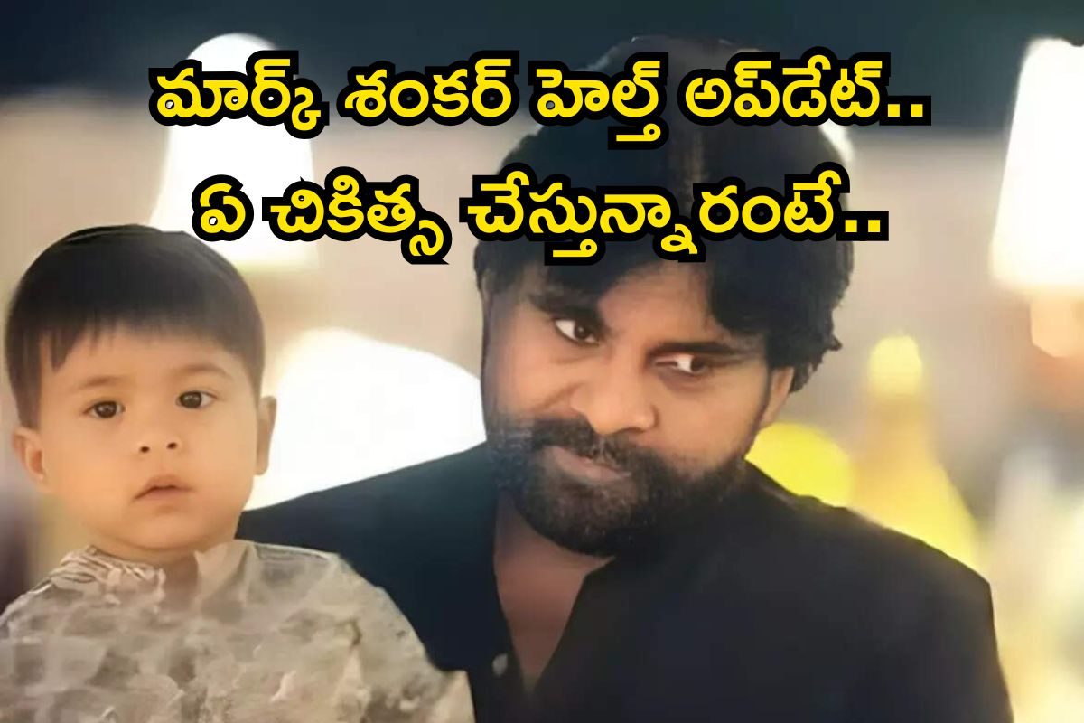 Pawan Kalyan: పవన్ కళ్యాణ్ కొడుకు మార్క్ శంకర్ హెల్త్ అప్‌డేట్.. డాక్టర్స్ ఏమన్నారంటే..!