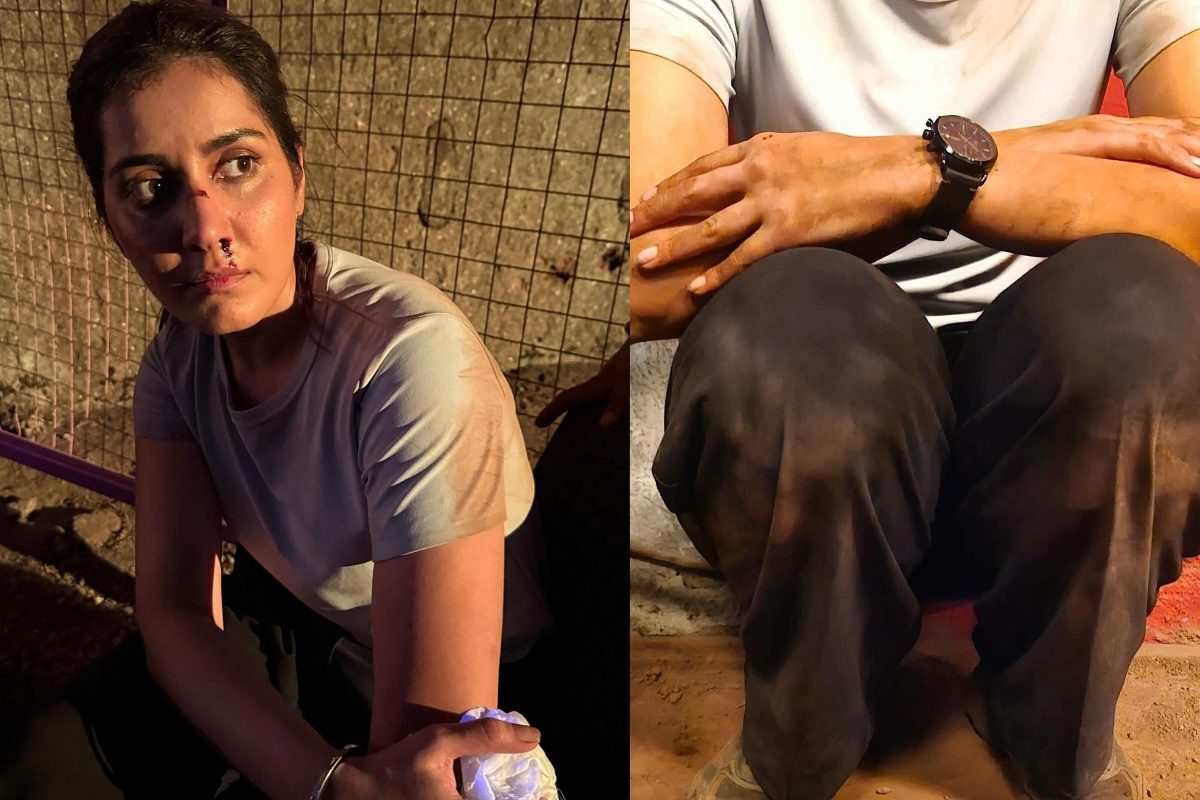 Tollywood Actress: యంగ్ హీరోయిన్ ఒంటినిండా గాయాలు.. ఆందోళనలో ఫ్యాన్స్, ఏం జరిగిందంటే..?