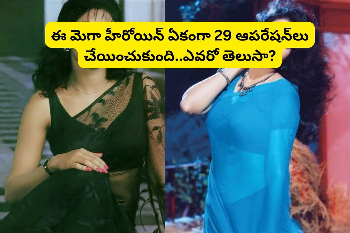 ఒకటి, రెండు కాదు.. ఏకంగా 29 ఆపరేషన్‌లు చేయించుకున్న టాలీవుడ్ స్టార్ హీరోయిన్.. ఎవరంటే?