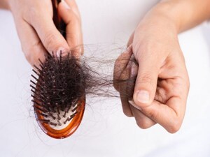 Winter Hair Fall: Why It Increases & How to Prevent It