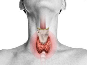 Thyroid: Can it be permanently cured? Understand types, treatments & lifelong management.