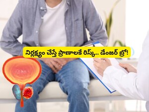 Prostate Cancer: Don't Miss Symptoms; Advanced Treatments Available