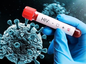 World AIDS Day 2025: Experts Reveal Key HIV Prevention Tips, Urge Early Testing and Awareness