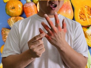 Uric Acid: Foods that spike levels fast; avoid major health risks.