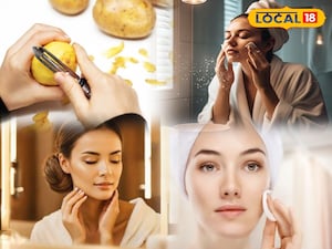 Viral Potato Beauty Tip: Natural Glow, Tight Skin, No Parlor Needed