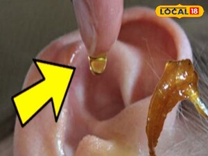 Ear Wax: Stop Risky DIY Removal, Use Safe Expert Methods