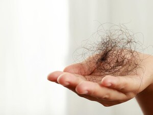 Homemade Hair Oil: Natural Solution for Hair Fall, Dandruff & Growth