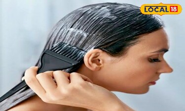 Beat Winter Hair Woes: Curd & Onion Juice for Dandruff, Hair Fall Solution!