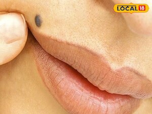 ऊपरी होंठ पर तिल: सामुद्रिक शास्त्र से जानें आपका भाग्य.