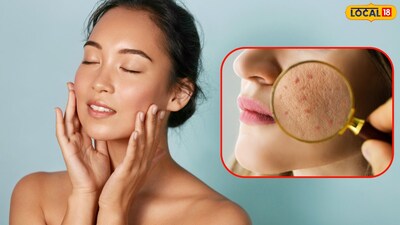 सर्दियों में पाएं चमकदार त्वचा: रसोई में मौजूद घी है आपका सौंदर्य रहस्य!