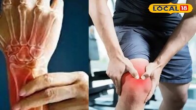 Bone Softening Risk in Women: Dr. Suresh Reveals How to Protect Your Bones