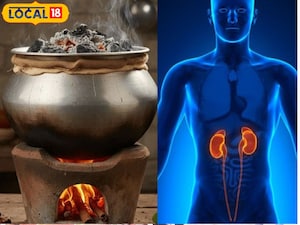 एल्युमीनियम के बर्तनों में खाना बंद करें: किडनी और दिमाग को गंभीर खतरा.