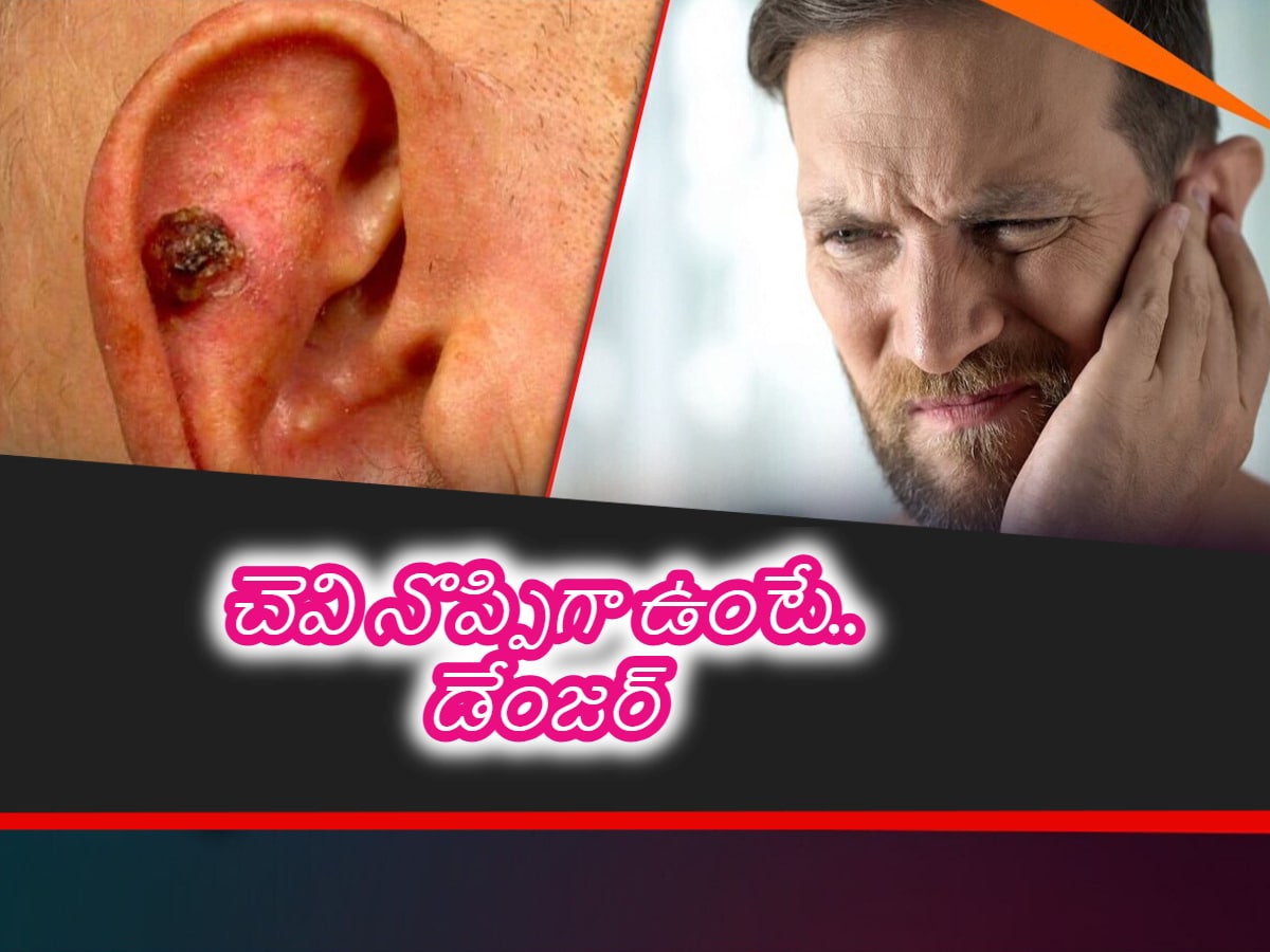 Ear Cancer: చెవి దగ్గర నొప్పి, పుండు అయిందా.. క్యాన్సర్‌ అని తేల్చే ...