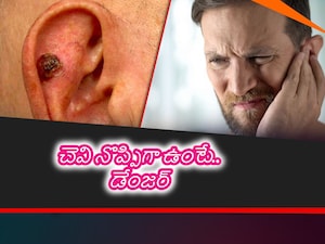 Ear Cancer: Don't Ignore Persistent Pain & These Critical Symptoms