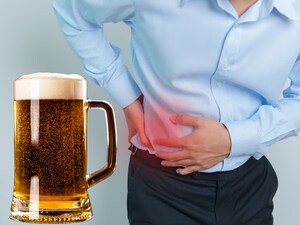 Kidney Stones and Beer: Debunking the Myth, Doctors Warn Against Self-Medication