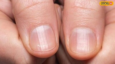 नाखूनों की वृद्धि से पता चलती है लंबी उम्र: हार्वर्ड के आनुवंशिकीविद् का चौंकाने वाला खुलासा