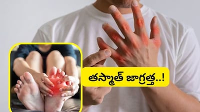 Uric Acid Alert: 5 Foods to Avoid for High Levels