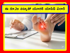 Uric Acid Remedy: యూరిక్ యాసిడ్ సమస్య చాలా పెద్దదే. కానీ దాన్ని సులభంగా తగ్గించుకోవచ్చు. అందుకు ప్రత్యేక చిట్కాలున్నాయి. ఇప్పుడు మనం ఈ ఆర్టికల్‌లో 3 సింపుల్ చిట్కాలు తెలుసుకుందాం. ఇవి చాలా ప్రభావవంతంగా పనిచేస్తాయి, పైగా తక్కువ ఖర్చుతో అయిపోతాయి. 