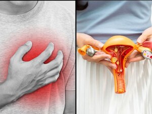 Uterine Fibroids Linked to 80% Higher Heart Disease Risk in Women: Study Warns