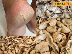 फटी एड़ियों का घरेलू इलाज: महंगे क्रीम छोड़ें, मूंगफली के छिलकों से पाएं मुलायम पैर