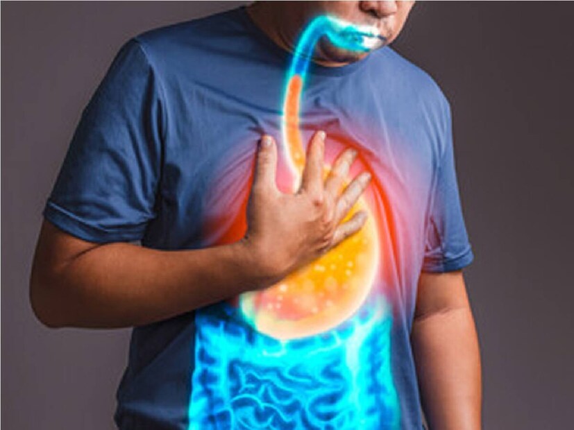 Acidity: అసిడిటీతో బాధపడుతున్నారా? తరచుగా గ్యాస్, గుండెల్లో మంటనా ...