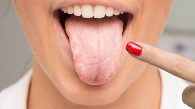 Tongue Health: 6 Dangerous Signs Your Tongue Reveals About Your Health