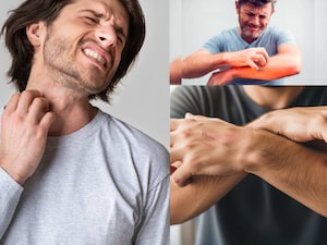 लगातार खुजली? यह एलर्जी नहीं, विटामिन की कमी का संकेत हो सकता है.