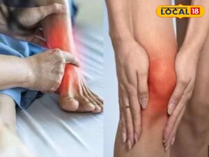 Uric Acid Trouble? 5 Home Remedies to Control Levels Naturally!