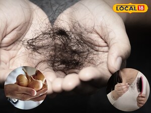 सफेद बाल गायब, हेयर फॉल बंद: प्याज-चाय पत्ती के मिश्रण से जादुई परिणाम.