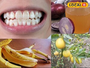दांतों को चमकाएं, बालों का झड़ना रोकें: 5 मुफ्त घरेलू नुस्खे जो देंगे अद्भुत परिणाम.