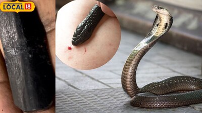 snake bite treatment