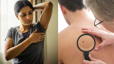 कैंसर के शुरुआती लक्षण: स्टेज 1 में पहचानें और जान बचाएं.