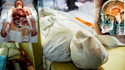 मृत्यु के 5 मिनट बाद शरीर में क्या होता है? चौंकाने वाले तथ्य सामने आए.