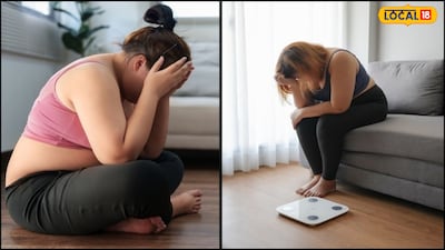 मोटापा संक्रमण से मृत्यु के जोखिम को 70% बढ़ाता है, प्रतिरक्षा प्रणाली को कमजोर करता है.