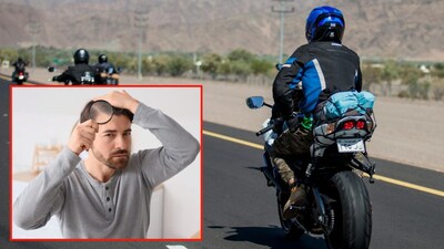 Helmet Hair Loss? Experts Reveal 'Traction Alopecia' & Prevention Tips