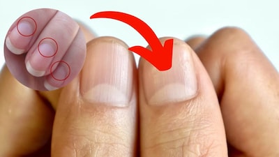 Nail Astrology: Your Lunula Reveals Luck & Future! What Does Your Mark Say?