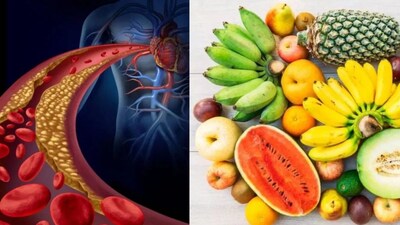 Beat Cholesterol Naturally: 5 Fruits That Slash Body Fat & Boost Heart Health!
