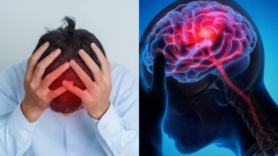 Brain Stroke: Don't Ignore Early Signs! Know Symptoms & Prevention