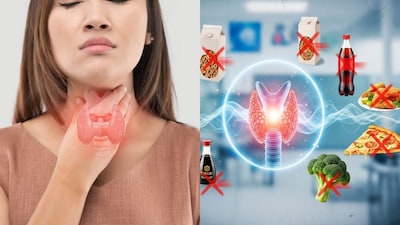 Thyroid Diet Guide: What to Eat & Avoid for Hormone Balance