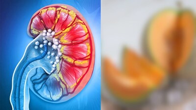 किडनीसाठी खरबूज: उन्हाळ्यात हे फळ खा, सौंदर्य आणि आरोग्य मिळवा